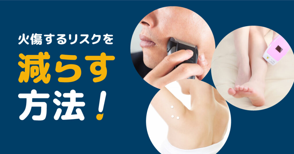 セルフ脱毛器で火傷するリスクを減らす方法
