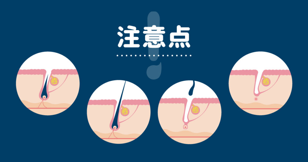 子供がセルフで脱毛を行うときの注意点