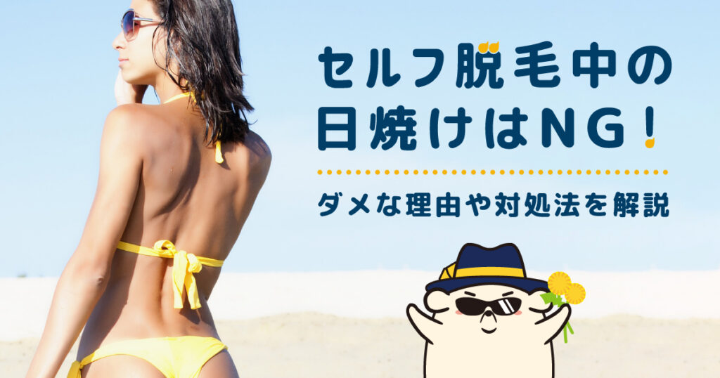 セルフでの脱毛中の日焼けはNG！ダメな理由や焼けたときの対処法について解説