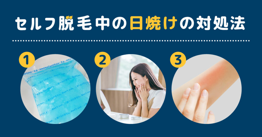 セルフでの脱毛中に日焼けしたときの対処法