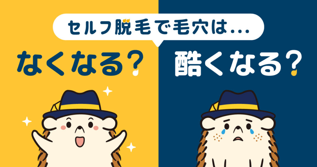 セルフ脱毛で毛穴はなくなる？酷くなる？ブツブツ毛穴を目立たなくする方法とは？