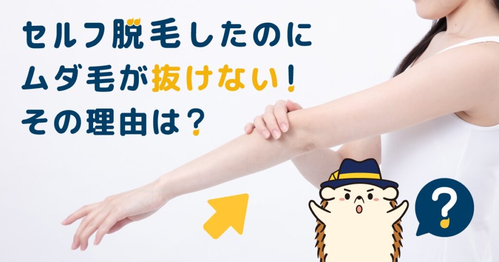 セルフ脱毛したのにムダ毛が抜けない！その理由は？