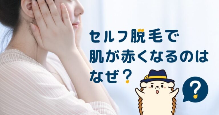 https://self-datsumou.life/blog/red/