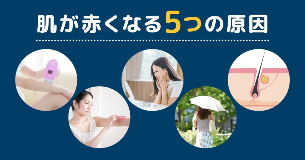 セルフ脱毛で肌が赤くなる5つの原因