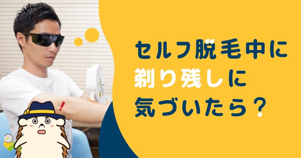 セルフ脱毛中に剃り残しがあることに気づいたら？