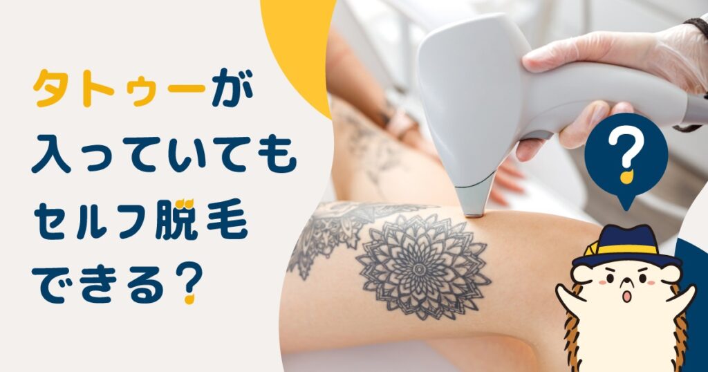 タトゥーが入っていてもセルフ脱毛できる？照射リスクやお手入れ方法を解説