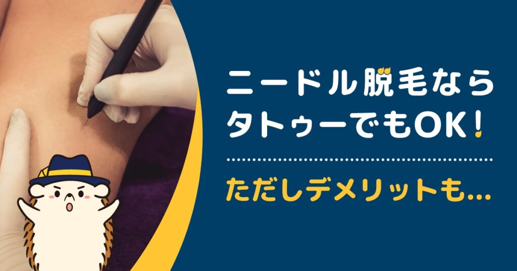 ニードル脱毛ならタトゥーがあってもOK!ただしデメリットも…