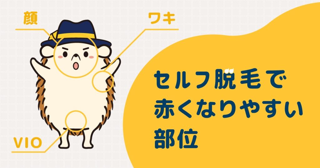 セルフ脱毛で赤くなりやすい部位