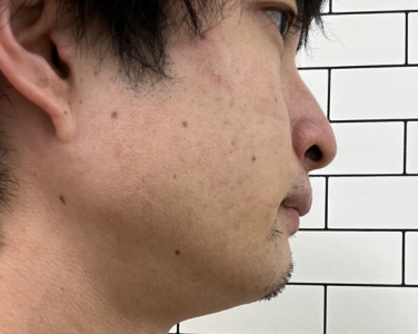 AFTER